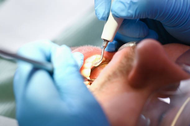 Best Emergency Care for Gum Disease in Man, IL
