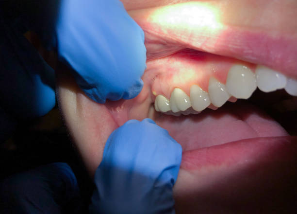 Best Emergency Denture Repair in Man, IL